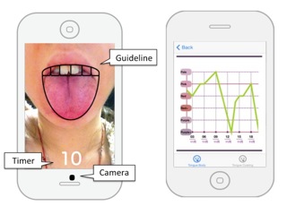TongueDx: スマートフォンのための舌診システム (210)