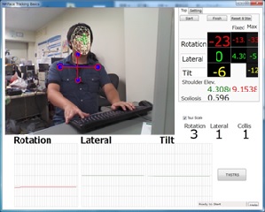 痙性斜頸患者に対するKinectを用いた姿勢評価システム (033)